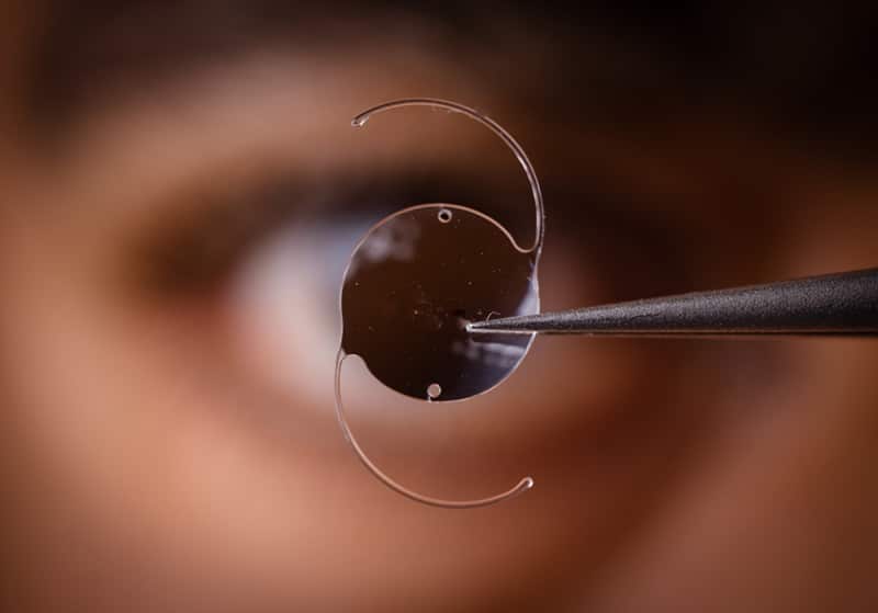 Closeup of an Intraocular Lens Implant